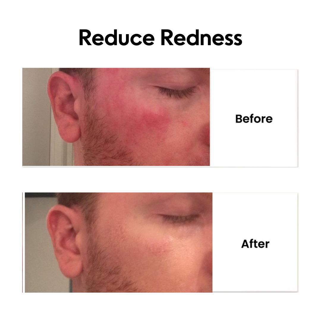 HepatoLife™ Milk Thistle Capsules